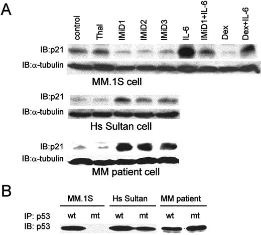Fig. 6. Effect of Thal and analogs on p21 expression in MM cell lines and patient cells. / (A) MM.1S cells were cultured with 10 μmol/L of Thal, IMiD1, IMiD2, and IMiD3 for 48 hours. MM.1S cells were also cultured with IL-6 (50 ng/mL) alone and with IMiD1, 10 μmol/L Dex, and Dex plus IL-6. Cells were lysed, subjected to SDS-PAGE, transferred to PVDF membrane, and blotted with anti-p21 Ab. The membrane was stripped and reprobed with anti-α-tubulin Ab. (B) MM.1S, Hs Sultan, and patient MM cells were lysed and immunoprecipitated with wt-p53 and mt-p53 Abs, transferred to PVDF membrane, and blotted with anti-p53 Ab.