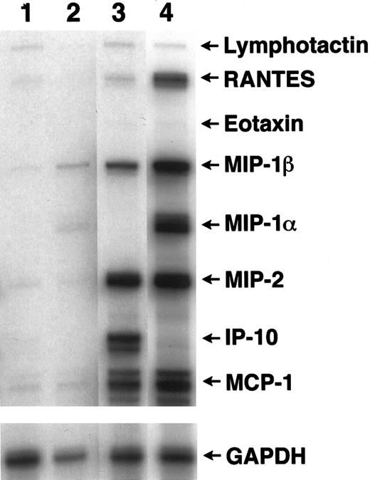 Fig. 5. Chemokine expression by GVHD-inducing T cells. / T cells from bm1 donors were transferred into irradiated MIP-1α−/− recipients. Ten days after transfer, the recipient mice were killed, and the splenoctyes were removed, selected for CD8+ cells, and stimulated twice in vitro with irradiated (2500 cGy) MIP-1α−/− splenocytes. The isolated T cells were then incubated with bone marrow–derived macrophages from MIP-1α−/− B6 or bm1 mice. The supernatants were harvested after 24 hours, and RNA was prepared from the cells as indicated. Lane 1: Macrophages from MIP-1α−/− mice; Lane 2: macrophages from bm1 mice; Lane 3: T cells incubated with syngeneic bm1 macrophages; and Lane 4: T cells incubated with class I disparate MIP-1α−/− B6 macrophages. Enhanced expression is found for RANTES, MIP-1β, and MIP-1α in the presence of an antigen (compare expressions in lane 3 vs lane 4).