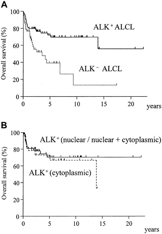 Fig. 2. Overall survival of ALK-positive and ALK-negative ALCL. / (A) ALK-positive ALCL shows significantly better prognosis (P = .0009). (B) No difference is seen in the pattern of ALK positivity (nuclear/nuclear + cytoplasmic vs cytoplasmic) (P = .61).