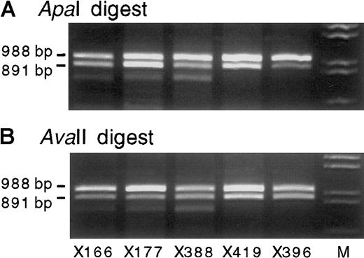 Fig. 2. Exon 8 and 9 IGF-2 RT-PCR products (primers 68 and 69) from 5 representative heterozygous bone marrow RNA samples digested with ApaI orAvaII. / All show biallelic transcription of IGF-2. The use of bothApaI (A) and AvaII (B) excludes misinterpretation from partial enzyme digestion, whereas the product size excludes DNA contamination (Figure 1). Lane M shows λDNA digested withHindIII and EcoRI. All gels shown contain 2% agarose gel with ethidium bromide.