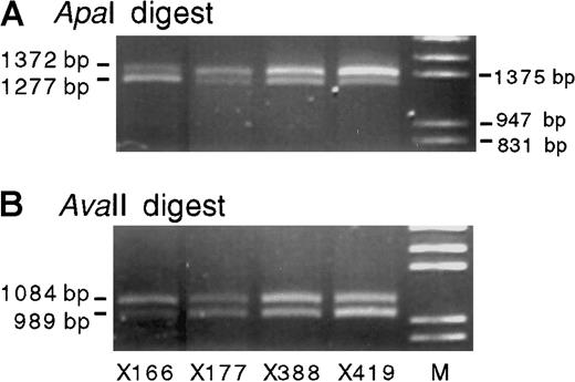 Fig. 3. Promoter 3-specific IGF-2 RT-PCR products (primers 442-69) from 4 heterozygous normal bone marrow RNA samples. / Digestion with either ApaI (A) or AvaII (B) confirms the presence of 2 transcribed alleles.