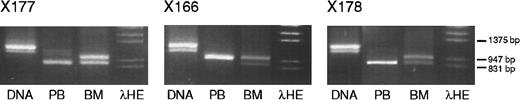 Fig. 4. IGF-2 PCR and RT-PCR products (primers 68 and 69) from DNA, peripheral blood RNA, and bone marrow RNA from each of 3 healthy volunteers. / Volunteers X177 and X178 express only the short allele in peripheral blood, whereas volunteer X166 expresses the long allele. A small amount of nonspecific PCR product is present in the peripheral blood lane of volunteer X177.