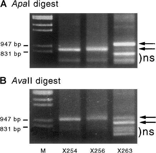 Fig. 5. Cord blood–derived IGF-2 RT-PCR products digested with ApaI andAvaII. / When digested with ApaI (A) or AvaII (B) they show monoallelic expression in specimens X254 and X256 but partial biallelic expression in X263 (arrows). Sample X263 also shows some shorter nonspecific (ns) PCR products that migrated in a similar position (below the bands of interest) before enzyme digestion. The ratio of the digested band intensity reflects the effect of heteroduplex formation on the digestion of PCR products. Results are consistent with a starting mix of A and B alleles of approximately 0.8:0.2. Assuming complete heteroduplex formation at the end of PCR cycling, the PCR products consist of a mixture of AA, AB, and BB duplexes in a ratio of a2:2ab:b2—ie, 0.64:0.32:0.04. On incubation with ApaI, only the BB homodimers are digested, resulting in a band ratio of 0.96:0.04 = 24:1 (undigested:digested), whereas incubation with the reciprocal enzyme AvaII products will only digest AA homodimers, resulting in a 0.36:0.64 ratio = 0.56:1. These ratios (24:1 and 0.56:1) are similar to those seen in Figure 5A and B, respectively.