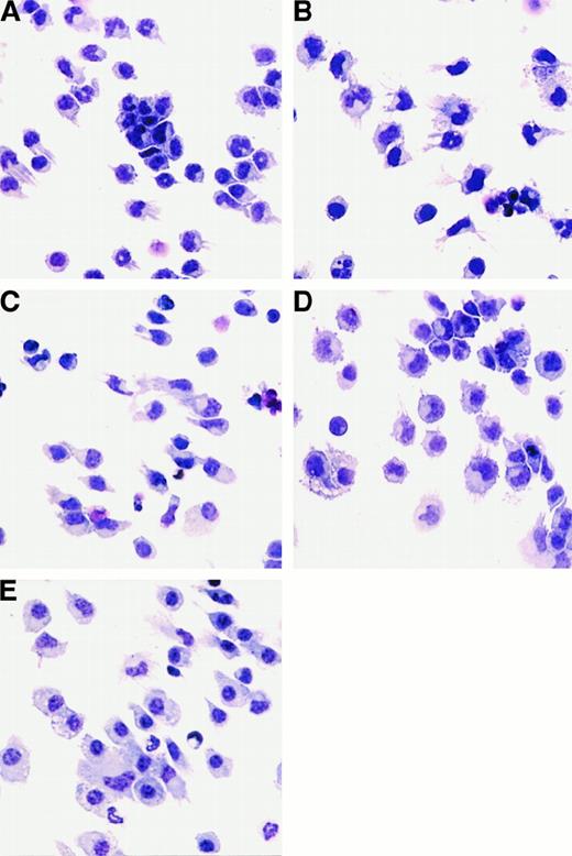 Fig. 5. Morphology of cells generated from FL-supplemented BM cultures. / Cells were harvested and cytospins prepared. Cytospun cells were photographed at 400 × magnification. BM cells from C57BL/6 mice were cultured in FL for 9 days alone (A) or stimulated for the final 24 hours of culture with the addition of LPS (B), IFN-α (C), or GM-CSF (D). (E) “Myeloid” DCs cultured in GM-CSF and IL-4 for 7 days.