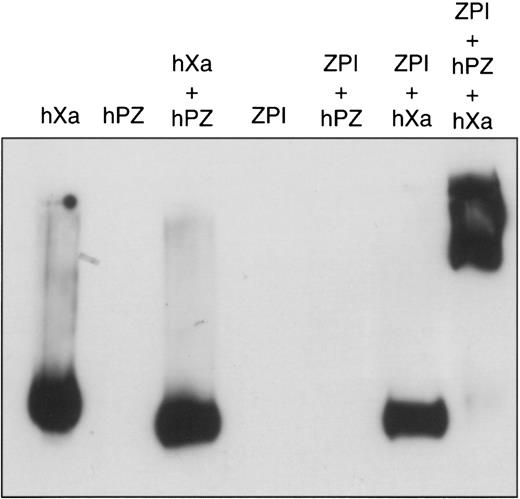 Fig. 3. Factor Xa–ZPI interaction on alkaline gel electrophoresis. / Mixtures containing various combinations of factor Xa (10 nmol/L), PZ (32 nmol/L), ZPI (28 nmol/L), cephalin (15 μmol/L), and CaCl2 (4 mmol/L) were incubated in HSA at room temperature. After 2 minutes, samples were separated by 8% alkaline-PAGE and analyzed by Western blotting with goat anti–factor Xa antibodies.