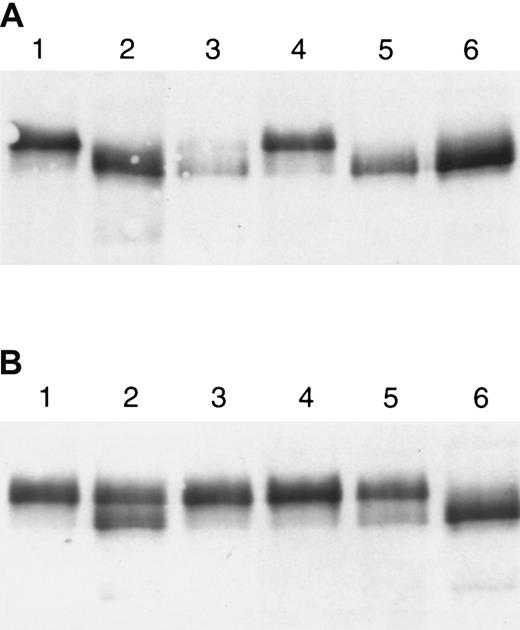 Fig. 7. Cleavage of ZPI during coagulation of plasma. / ZPI in plasma and serum samples (see “Materials and methods”) was immunoadsorbed with rabbit polyclonal anti-ZPI antibodies bound to Affigel and detected following SDS-PAGE by Western blotting with monoclonal anti-ZPI antibody (MC4249.2). (A) Lane 1: normal plasma; lane 2: normal plasma treated with kaolin, phospholipids, and Ca++; lane 3: normal plasma treated with kaolin alone; lane 4: factor XI–deficient plasma treated with kaolin alone; lane 5: normal plasma treated with tissue thromboplastin and Ca++; lane 6: factor XI–deficient plasma treated with tissue thromboplastin and Ca++. (B) Lane 1: factor X–deficient plasma; lane 2: factor X–deficient plasma treated with kaolin, phospholipids, and Ca++; lane 3: factor X–deficient plasma treated with tissue thromboplastin and Ca++; lane 4: barium adsorbed plasma (BAP) treated with XCP, phospholipids, and Ca++; lane 5: BAP supplemented with factor X treated with XCP, phospholipids, and Ca++; lane 6: BAP supplemented with factor X and PZ treated with XCP, phospholipids, and Ca++.