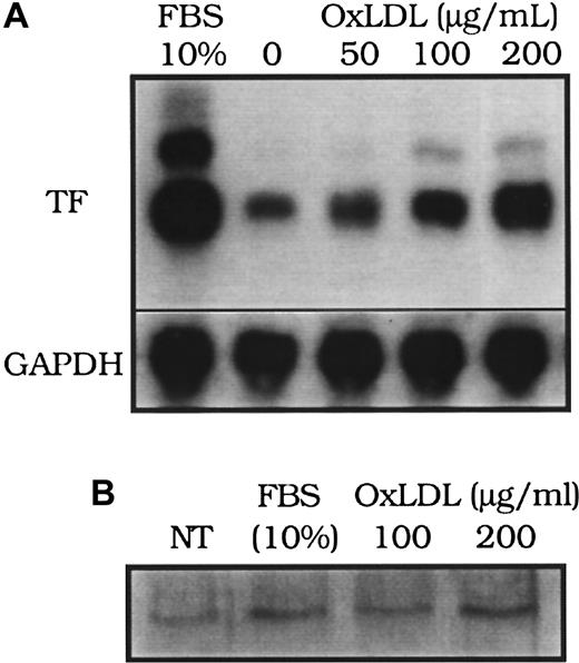 Fig. 2. Effect of oxidized LDL on tissue factor mRNA and protein. / (A) Tissue factor (TF) mRNA from rat aortic smooth muscle cells was assessed by Northern blot analysis 90 minutes after the addition of fetal bovine serum (FBS, 10%), or oxidized LDL at 0, 50, 100, and 200 μg cholesterol/mL. (B) Tissue factor surface protein immunoprecipitated from 50 μg of cell lysate of human aortic smooth muscle cells was assessed by Western blot analysis 4 hours after “no treatment” (NT; control), FBS (10%), or oxidized LDL (100 or 200 μg cholesterol/mL). Glyceraldehye 3-phosphate dehydrogenase (GAPDH) was assessed as an internal control to confirm equal loading in each lane for Northern blot analysis.
