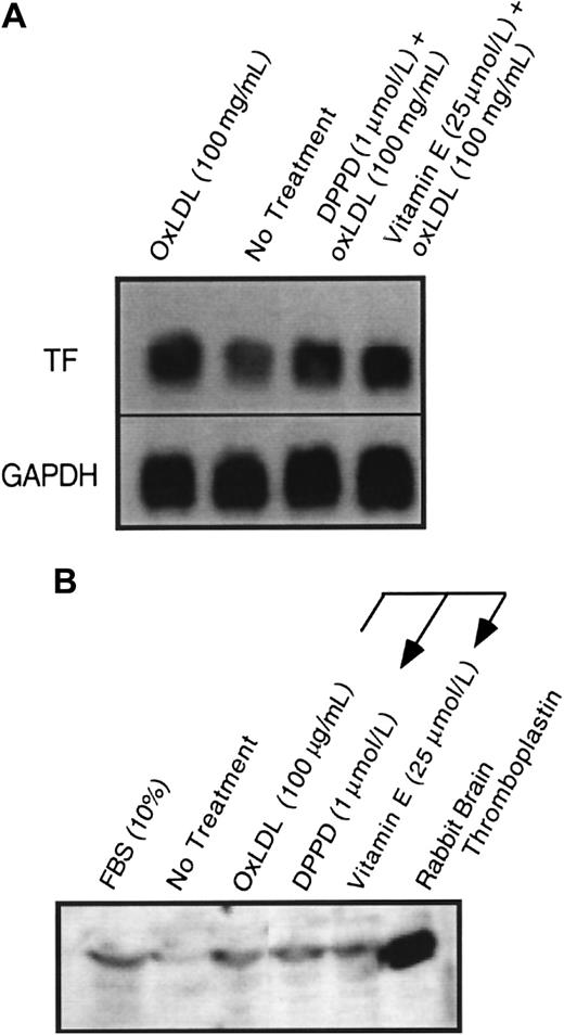 Fig. 4. Effect of α-tocopherol and DPPD pretreatment on oxidized LDL induction of tissue factor mRNA and protein. / Tissue factor (A) mRNA by Northern blot at 90 minutes and (B) total cellular protein by Western blot at 4 hours was assessed after the addition of oxidized LDL at 100 μg protein/mL to plates of (A) rat or (B) human aortic smooth muscle cells. Cells were pretreated with either α-tocopherol (25 μmol/L) or DPPD (1 μmol/L) for 24 hours before the addition of oxidized LDL. GAPDH was assessed as an internal control to confirm equal loading in each lane for Northern blot analysis.