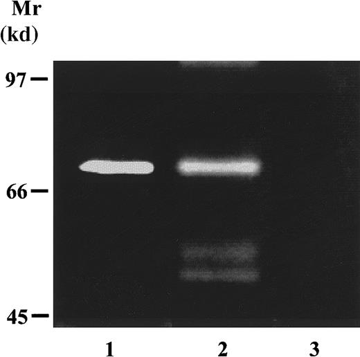 Fig. 1. Expression of MMP2 by human platelets. / Human washed platelets were resuspended in Tyrode's buffer and were divided into 2 groups corresponding to resting and collagen- (1 μg/mL) aggregated platelets. Supernatants from resting and activated platelets as well as the platelet pellet solubilized in the sample buffer (lane 3) were studied by gelatin zymography in a 7.5% acrylamide gel containing 1-mg/mL gelatin under nonreduced conditions. Gelatinolytic activity at 68 kd and at 62 to 59 kd was visualized, indicating the presence of MMP2 in proform in resting platelets (lane 1) and in proform and activated forms in activated platelets (lane 2).