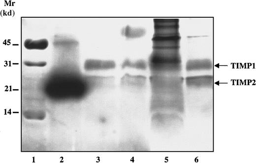 Fig. 3. Expression of TIMP1 and TIMP2 in human platelets. / Resting and collagen- (1 μg/mL) activated platelets were centrifuged and analyzed for TIMP expression by reverse zymography. Lane 1: molecular weight markers; lane 2: human recombinant TIMP2; lane 3: supernatants from resting platelets; lane 4: supernatants from activated platelets; lane 5: activated platelet pellet; lane 6: purified platelet membranes.