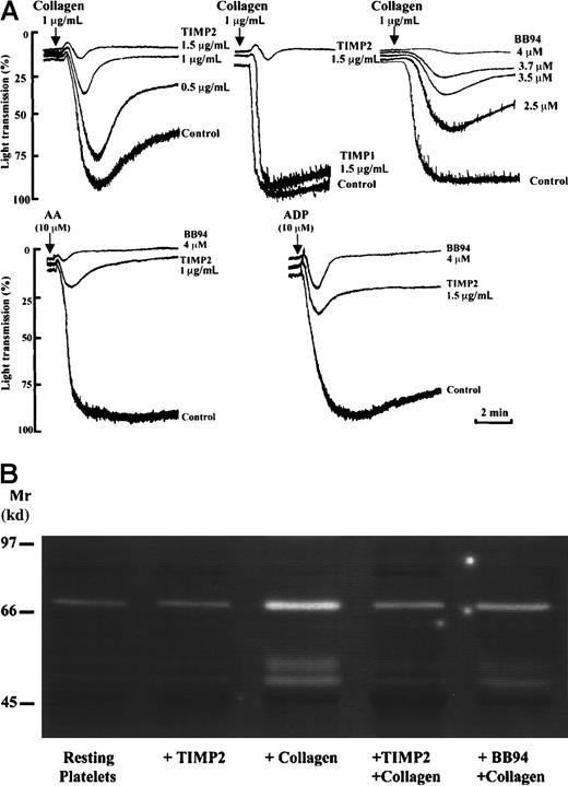 Fig. 6. Inhibition of platelet aggregation by TIMP2 and BB94. / (A) Platelets were pretreated for 2 minutes with MMP inhibitors as indicated and then triggered by collagen (1 μg/mL), AA (10 μmol/L), or ADP (10 μmol/L). The figure shows the inhibition by TIMP2 (0.5-1.5 μg/mL) and BB94 (2.5-4 μmol/L) but not by TIMP1 (1.5 μg/mL) of platelet response. Results are representative of 3 separate experiments. (B) The supernatants of platelets treated as indicated on the figure were analyzed by gelatin zymography.
