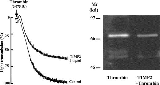 Fig. 7. Effect of TIMP2 on thrombin-induced platelet aggregation and MMP2 activation. / (Left panel) The platelets were pretreated for 2 minutes with TIMP2 (1 μg/mL) and exposed to thrombin (0.075 IU/mL). (Right panel) The supernatants of platelets treated as indicated were studied by gelatin zymography.