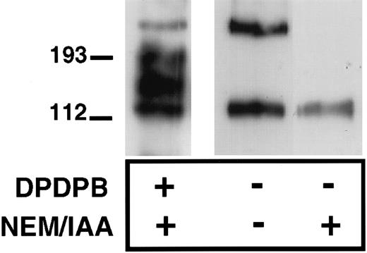 Fig. 3. Formation of P-selectin dimers in vitro. / Resting platelets were lysed in the absence (−) or presence (+) of alkylating agents NEM and IAA and then immunoprecipitated with a P-selectin–specific polyclonal antibody, as described in “Materials and methods.” In the first lane, cross-linker (DPDPB)–treated platelets were lysed in the presence of alkylating agents, and P-selectin was immunoprecipitated with the polyclonal antibody. Immunoprecipitates were separated on 6% SDS gels and analyzed by immunoblotting using the P-selectin monoclonal antibody AK4.
