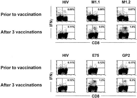 Fig. 3. IFN-γ staining before and after 3 vaccinations. / Intracellular IFN-γ staining in patient no. 10 (upper panel) and patient no. 6 (lower panel) before and after 3 vaccinations. PBMNCs from each patient were incubated with autologous PBMNCs pulsed with the indicated peptides for 6 hours, and IFN-γ production was assessed by flow cytometry after intracellular staining for IFN-γ in CD8 positive lymphocytes. Numbers represent the percentage of IFN-γ–expressing cells in the lymphocyte gate.