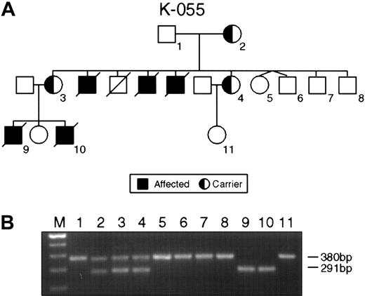 Fig. 1. Intragenic deletions in the SH2D1A gene in families K055 and K061. / (A) Pedigree K055 shows XLP female carriers (2-4) affected males (9, 10) and unaffected persons (1, 5-8). (B) PCR product amplified with XLP2 primer pairs. Consistent with the pedigree, lanes 1, 5, 6, 7, and 8 indicate the product of 380 bp of normal SH2D1A. Lanes 2, 3, and 4 show the result of the PCR on DNA obtained from the obligate carriers; normal (380 bp) and mutant (291 bp) alleles are present. Lanes 9 and 10 display the result of PCR on DNA from affected males.