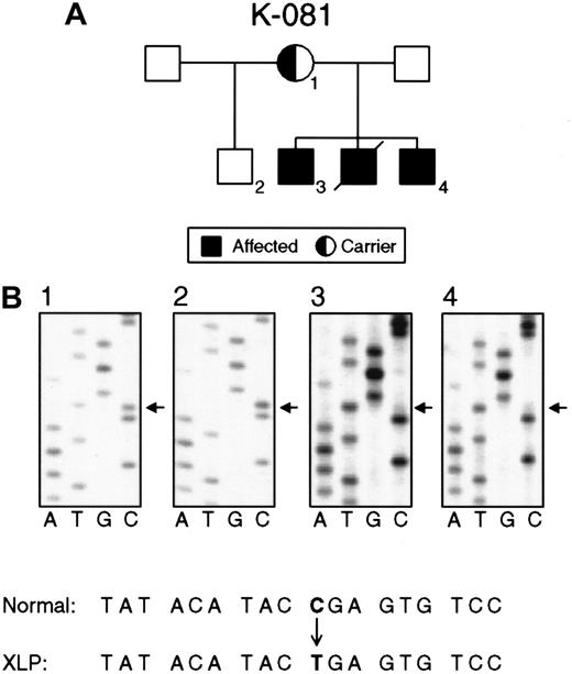 Fig. 2. Nucleotide substitutions in the SH2D1A gene in families K081 and K089. / (A) Pedigree K081 shows XLP female carriers (1), normal persons (2), and affected males (3, 4). (B) Direct sequencing of PCR products demonstrating a nucleotide substitution (C462T) in exon 2 that causes a premature stop in the translation of SH2D1A. The status of the SH2D1A gene in an obligate carrier (1), unaffected person (2), and affected persons (3, 4).