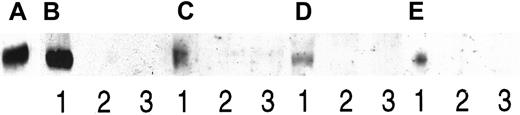 Fig. 3. Coprecipitation of syndecan-1 and HGF. / Two myeloma cell lines and pleural fluid from 2 patients with myeloma were examined for complexes of syndecan-1 and HGF by coprecipitation. Proteins on the blot were, in all cases, stained with anti-HGF antibodies. Protein was immunoprecipitated with the anti–syndecan-1 antibody BB-4 (lane 1), BB-4 in the presence of heparin (lane 2), and an irrelevant antibody (lane 3). Panels A-E consist of (A) 3 ng of purified HGF as a control, (B) immunoprecipitates from the ANBL-6 cell line, and (C) immunoprecipitates from the JJN-3 cell line. (D) and (E) are immunoprecipitates from patients with myeloma 1 and 2, respectively.