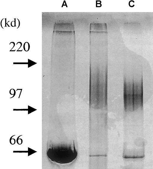 Fig. 6. Purification of syndecan-1 from U-266 cell line. / Soluble syndecan-1 was purified from conditioned medium of U-266 myeloma cells. Four microliters of sample from each purification step was loaded onto a precasted gel (4% to15%). Proteoglycans were detected by combined alcian blue/silver staining.27 By this procedure, GAG chains stain before proteins. The development step was stopped after approximately 2 minutes in this experiment, therefore mainly GAG chains and albumin appear. Lane A: conditioned medium from U-266 cells. Lane B: after Q-sepharose column to remove serum proteins and reduce the volume of the sample. Lane C: after purification of the sample on a B-B4 immunoaffinity column (albumin added to sample after purification).
