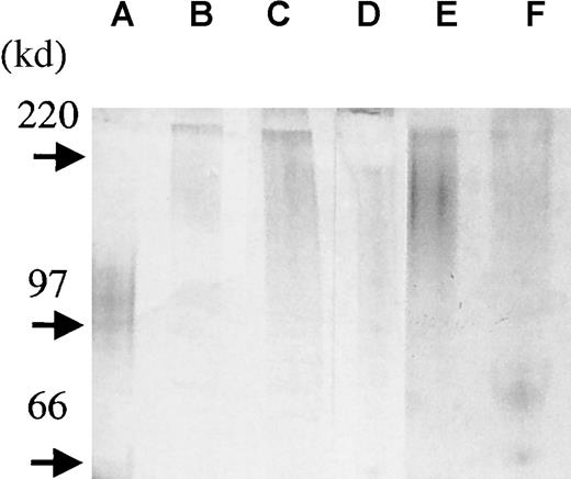 Fig. 7. Syndecan-1 isolated from patient samples exists in an intact form. / To assess the size and to establish the intactness of the syndecan-1 in vivo, syndecan-1 was isolated from bone marrow plasma of 3 patients with myeloma (lanes b-d) and pleural fluid from 2 patients with myeloma (lanes e-f). Purified syndecan-1 from the U-266 cell line is shown in lane a. Four microliters of each sample was loaded onto a precasted gel (4% to 15%). Proteoglycans were detected by combined alcian blue/silver staining.27