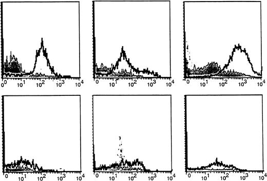 Fig. 2. Expression of the CA27.29 MUC1 epitope on MM patient and HD BM plasma cells. / CA27.29 expression on bone marrow plasma cells (CD38hi45RA−/lo scattermod/hi) from 3 representative MM patients (upper panels) and 3 representative healthy donors (lower panels) are shown. CA27.29 expression on plasma cells was determined by multiparameter flow cytometry. Shaded peaks denote isotype control staining.