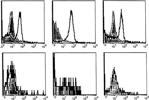 Fig. 3. Expression of the CA27.29 MUC1 epitope on MM patient and HD B cells. / CA27.29 expression on peripheral blood B cells (CD19+) from 3 representative MM patients (upper panels) and 3 representative healthy donors (lower panels) are shown. CA27.29 expression on PB B cells was determined by multiparameter flow cytometry. Shaded peaks denote isotype control staining.