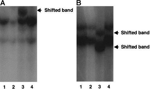 Fig. 1. RT-PCR-SSCP analyses of exons 3, 4, 5, and 6 of the. / AML1 gene in patients with MDS. (A) An abnormal migrating band was detected in lane 3 (a case with CMMoL) in addition to bands with normal mobility. (B) Abnormal migrating bands were detected in lane 3 (a case with AML secondary to MDS). The other lanes are also derived from the cDNA samples of MDS patients. Shifted bands are marked with arrows.