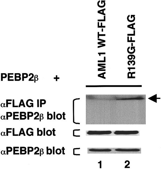 Fig. 6. In vitro interaction between the AML1 mutants and PEBP2β/CBFβ. / The total cell lysates of COS-7 cells containing the same amount of FLAG-tagged wild-type AML1 (lane 1) or AML1 R139G (lane 2) were incubated with the cell lysates containing PEBP2β/CBFβ for 2 hours. These cell lysates were precleared by protein G–sepharose and incubated with the anti-FLAG antibody for 3 hours; this was followed by recovery of the FLAG-tagged protein on protein G–sepharose beads. The beads were subjected to SDS-PAGE and Western blotting with the anti-PEBP2β antibody. The arrow indicates migration of PEBP2β/CBFβ.