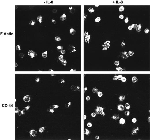 Fig. 2. Analysis by confocal microscopy of F-actin and CD44 in HCs on HA with or without IL-8. / HCs adherent to HA were stained with rhodamine-phalloidin (for F-actin) or with an anti-CD44 MoAb. In the absence of IL-8, both F-actin and HA showed a polarized distribution in many cells, whereas few or no such polarized cells were observed in the presence of IL-8 (representative examples of 6 separate experiments).