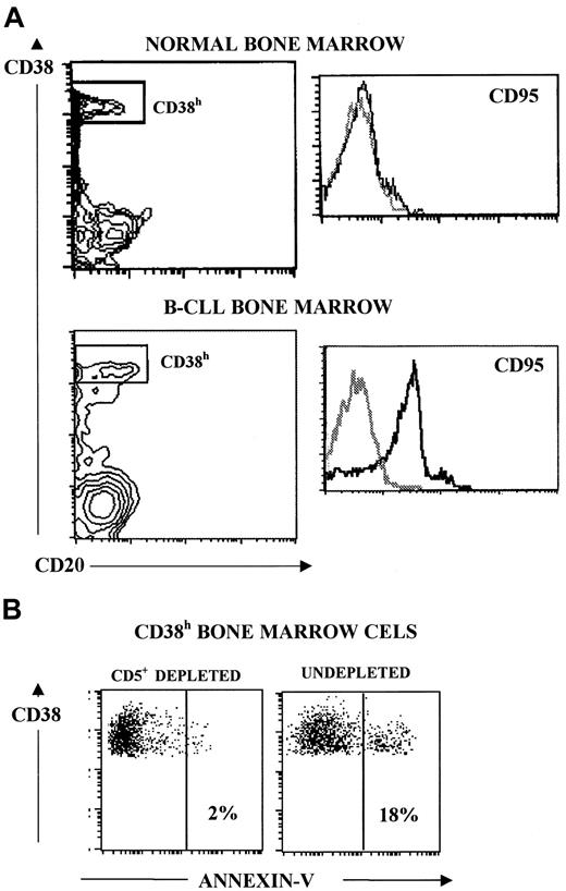 Fig. 3. CD95 expression and apoptotic induction in patients' BM plasma cells (CD38h cells). / (A) Three-color staining and flow cytometry analysis for CD95 expression by BM plasma cells from healthy subjects (upper panel) and patients with B-CLL (lower panel). Plasma cells were selected in a CD38 CD20 plot as cells CD38h CD20−. CD95 expression is shown in histograms. The results shown are representative of 8 and 5 experiments for patients with B-CLL and healthy BM samples, respectively. (B) BM cells (106 cells/mL) were cultured alone and in combination with untreated autologous B-CLL cells (106 cells/mL) for 48 hours. After this period, apoptotic BM plasma cells were determined in both kinds of culture as CD38h annexin V+ cells. Results of one representative experiment are shown.