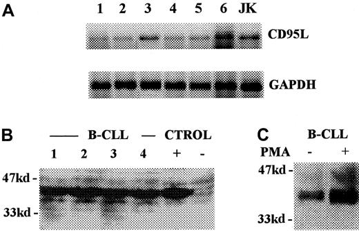 Fig. 4. Presence of CD95L in B-CLL cells. / (A) Reverse transcription–PCR detection of CD95L mRNA. Lanes 1 to 6 correspond to B-CLL cells from different patients. Lane 7 corresponds to Jurkat cells induced by PMA and ionomycin (positive control). GAPDH mRNA was used as mRNA quantity control. (B) Western blot analysis of CD95L expression in B-CLL lymphocytes (lanes 1 to 4). Lanes 5 and 6 correspond to Jurkat cells cultured in the presence (positive control: +) and in the absence (negative control: −) of PMA plus ionomycin. (C) Western blot analysis of the expression of CD95L proteins by nonstimulated (control) and PMA-induced B-CLL cells.