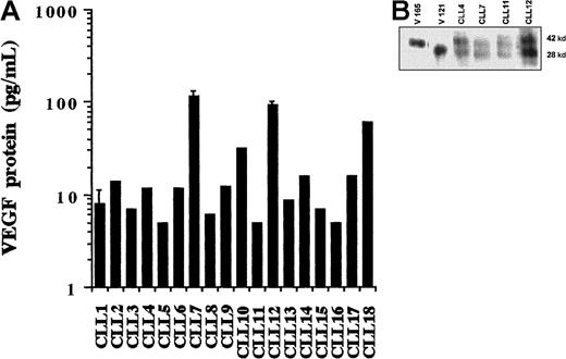 Fig. 2. Detection of VEGF protein. / (A) ELISA measurement of secreted VEGF. Levels of VEGF in the CM collected from unstimulated CLL cells were measured using a commercial ELISA kit. The amount of VEGF protein in the samples was calculated using a reference curve established from serial dilutions of rhVEGF protein. Individual histograms represent the means of duplicates. Error bars are standard deviations calculated from 6 measurements in 3 separate experiments using the cells of 3 different patients. (B) Western blot analysis of secreted VEGF. CM was collected from cultures of the PMA-stimulated cells and subsequently concentrated by 10-fold. Each sample (100 μL) was loaded onto a 10% polyacrylamide gel and electrophoresed under nonreducing conditions. Separated proteins were transferred to a nitrocellulose membrane, and VEGF protein was detected with anti-hVEGF mAb and visualized by enhanced chemiluminescence.