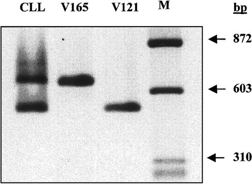 Fig. 4. Analysis of VEGF mRNA isoforms by RT-PCR. / First-strand cDNA was transcribed from 1 μg total RNA extracted from unstimulated cells. One tenth of the synthesized cDNA was amplified by PCR using primers recognizing all possible VEGF isoforms. VEGF 165 and VEGF 121 cDNAs were included in the PCR reaction as the positive controls.