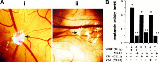 Fig. 6. Angiogenic responses of CAM to CM derived from CLL cells. / (A) Representative angiogenic response and its inhibition by a blocking anti-hVEGF mAb. The white area represents the site of application of filters containing either CM (collected from the PMA-stimulated cells) alone (i) or the same CM preincubated with anti-hVEGF MoAb for 2 hours at RT (ii). Microvessels radiating from the site of sample application in (i) are not formed in the presence of the blocking mAb (ii). (Original magnification, × 8.) (B) The semiquantitative data obtained by using rhVEGF and CM collected from PMA-stimulated cells from 2 patients. The grading of the angiogenic response is described in “Materials and methods.” *P < .05 vs control andP < .05 vs sample without the neutralizing antibody (Mann-Whitney U test). Each bar represents the score of 10 CAM used in 2 separate assays with similar results.
