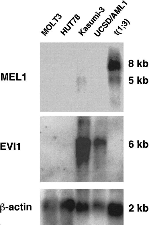 Fig. 3. Expression of the MEL1 gene in mRNA from leukemia cells with t(1;3)(p36;q21) by Northern hybridization. / The MEL1 transcript (8 kb) was expressed in leukemia cells with t(1;3)(p36;q21) (lane 5). However, the MEL1 gene did not express in other leukemia cell lines, HUT78 (lane 1), MOLT3 (lane 2), Kasumi-3 (lane 3), and UCSD/AML1 (lane 4). The same membrane was hybridized to EVI1 or β-actin probes, sequentially.EVI1 transcripts (6 kb) were expressed in both Kasumi-3 with t(3;7)(q26;q22) (lane 3) and UCSD/AML1 with t(3;3)(q21;q26) (lane 4).