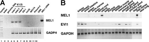 Fig. 4. Detection of the MEL1 expression in patient RNA, cell lines, and organs by RT-PCR. / (A) Expression of the MEL1 gene in RNA from patient leukemia cells or cell lines by RT-PCR. Each transcribed cDNA from leukemia cells with t(1;3)(p36;q21) or cell lines as source of RT-PCR was amplified by the MEL1 specific primers (see “Methods and materials”). Lanes are indicated as follows: 1, 1-kb ladder marker (Promega Biotech); 2, negative control (water); 3, control genomic DNA; 4 to 6, leukemia cells with t(1;3)(p36;q21), cases 1 to 310; 7, KG-1; 8, leukemia cells with inv(3); 9, MOLT4; 10, Kasumi-4; 11, CMK; and 12, MEL1 cDNA fragment (N1163) as a positive control. (B) Expression of the MEL1 gene in various organ RNAs by RT-PCR. The MEL1 and EVI1expressions were analyzed in various organs by RT-PCR using each specific primer set.