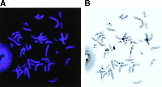 Fig. 5. The MEL1 gene is localized to 1p36.3 by fluorescence in situ hybridization (FISH) analysis. / FISH was carried out with the MEL1 cDNA clone (N1163) as a probe by the method described previously. Hybridization of an FITC-labeled probe to human metaphase spread shows specific green signals (A) on chromosome 1 at band p36.3 (B). Original magnification × 1000.