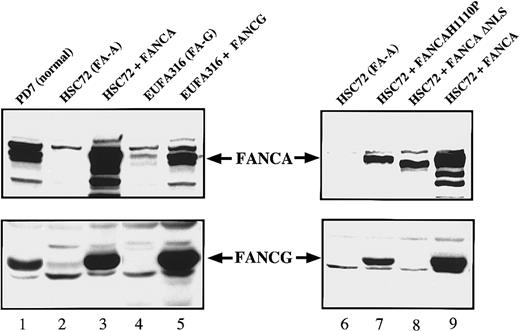 Fig. 2. Expression of FANCA and FANCG protein stabilizes the FA protein complex. / Whole cell extracts were prepared from the indicated lymphoblast lines and analyzed by immunoblotting for expression of the FANCA and FANCG proteins.