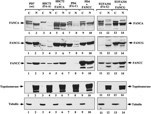 Fig. 4. FANCG binding promotes the nuclear accumulation of the FANCA protein. / The indicated isogenic pairs of mutant and corrected lymphoblasts were fractionated into cytoplasmic and nuclear components. A control normal lymphoblast line (PD7) was also included. Protein (100 μg) from each sample was electrophoresed; transferred to nitrocellulose; and immunoblotted with anti-FANCA antiserum, anti-FANCG antiserum, or anti-FANCC antiserum (first 3 panels, respectively). To ensure effective fractionation, the same samples were analyzed for topoisomerase (nuclear) and β-tubulin levels (cytoplasmic). Note that the FANCA antiserum reacts nonspecifically with a protein that runs just above the FANCA band (indicated by an arrow in the FANCA panel), and the antiserum is present in all samples including the HSC72 cells, which do not express any FANCA protein.