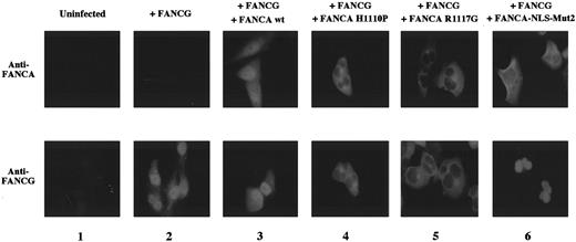 Fig. 5. Patient-derived mutant forms of the FANCA protein bind and retain FANCG in the cytoplasm. / GM6914 fibroblasts (FA-A) were infected with the pMMP-FANCG retrovirus either alone (column 2) or in combination with the pMMP-FANCA wt (column 3), pMMP-FANCA-H1110P (column 4), pMMP-R1117G (column 5), or pMMP-FANCA-NLS-Mut2 (column 6) retrovirus. Pools of infected cells were stained with anti-FANCA (upper panels) or anti-FANCG antiserum (lower panel) and analyzed by immunofluorescence. The GM6914 cells express no FANCA protein (column 1, upper panel) and only low levels of FANCG, which were not detected by our anti-FANCG antibody (column 1, lower panel). The presence of the FANCG protein in the nucleus in panels 4, 5, and 6 may reflect the relative stability of the free (non–FANCA-bound) FANCG protein in fibroblasts compared to the lymphoblasts examined in Figures 3 and 4.