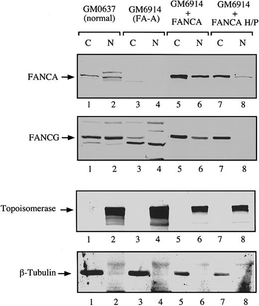 Fig. 6. Analysis of the subcellular localization of endogenous FANCG protein by cell fractionation. / The FA-A fibroblasts GM6914 were infected with a retrovirus carrying the wild type FANCA cDNA (lanes 5 and 6) or the mutant FANCA-H1110P cDNA (lanes 7 and 8). The parental (uninfected) and infected GM6914 cells, together with a normal control fibroblast line (GM0637, lanes 1 and 2), were fractionated into cytoplasmic and nuclear components. Samples from all fractions were analyzed by immunoblotting with antisera to FANCA and FANCG. To ensure effective fractionation, the same samples were analyzed for topoisomerase (nuclear) and β-tubulin levels (cytoplasmic).