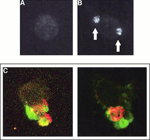 Fig. 3. CD36 is clustered during PE phagocytosis. / Purified human monocytes were incubated with PE preparations for 4 hours, at which time the cells were extensively washed, adherent erythrocytes lysed, and monocytes fixed in 100% methanol. (A) A typical monocyte that has not ingested any PEs is stained with FITC-labeled anti-CD36 OKM5 and analyzed by immunofluorescent microscopy. The cell outline can be readily appreciated. (B) A monocyte that has ingested 2 PEs. The position of the PEs as determined by light microscopy is indicated by arrows. The cell is stained with FITC-labeled OKM5 antibody; immunofluorescent microscopy demonstrates the dense clustering of CD36 at the site of PE ingestion. (C) After a 4-hour nonopsonic phagocytosis assay, monocytes were fixed in 100% methanol, stained first with the PE-specific IC4 monoclonal antibody, then with Texas red–labeled antimouse secondary, and finally with FITC-labeled anti-CD36 OKM5 antibody. Each panel shows single monocytes that have ingested 1 (right panel) or 2 (left panel) PEs. Note the dense clustering of CD36 (green) surrounding the PEs (red) and colocalizing with them (as evidenced by yellow staining). Results shown are representative of 4 independent experiments.