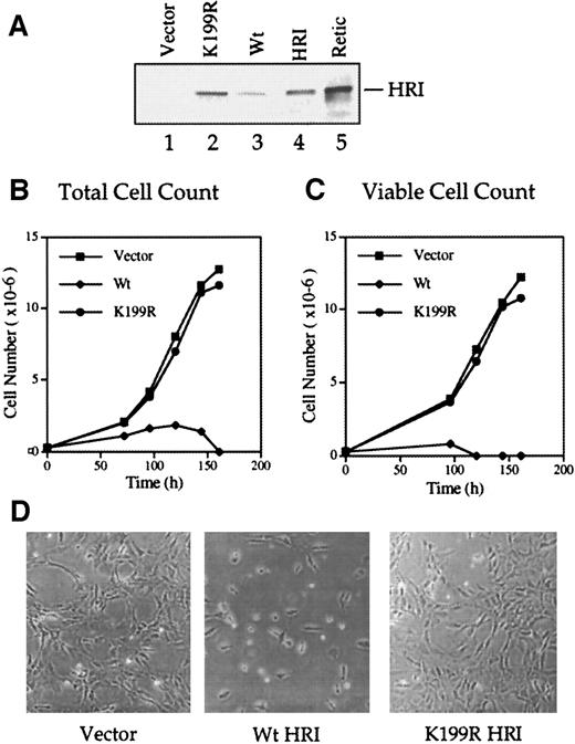 Fig. 2. Growth characteristics of NIH 3T3 cells overexpressing Wt and K199R HRI. / (A) Levels of HRI protein expression. NIH 3T3 cells overexpressing vector alone (lane 1), Wt HRI (lane 3), or K199R HRI (lane 2) were generated by infections with retroviruses as described in “Materials and methods.” Cytoplasmic extracts (20 μg) from these cells, as indicated in the Figure, were separated by 7.5% sodium dodecyl sulfate–polyacrylamide gel electrophoresis (SDS-PAGE) and analyzed for HRI by Western blot analysis. Purified rabbit reticulocyte HRI (lane 4) and reticulocyte lysates (lane 5) were used as positive controls. (B) Growth curve using total cell numbers. NIH 3T3 cells expressing either the pLXSN retroviral vector alone, Wt HRI, or K199R HRI were seeded at equal densities of (2.5 × 105) per 100 mm. Cells expressing Wt HRI were washed 3 times with DMEM to remove the hemin supplemented in the medium and maintained in the culture medium without hemin supplement for 24 hours prior to seeding. Total numbers of cells at different times of culture were plotted. (C) Growth curve of viable cells. Cells were grown as described in panel B, and the cell viability was determined by staining with trypan blue. The number of trypan blue–negative cells was plotted relative to time in culture. (D) Phase contrast photographs. NIH 3T3 cells expressing vector, Wt, or K199R HRI at day 3 of growth as shown in panels B and C were photographed at 200 × magnification.