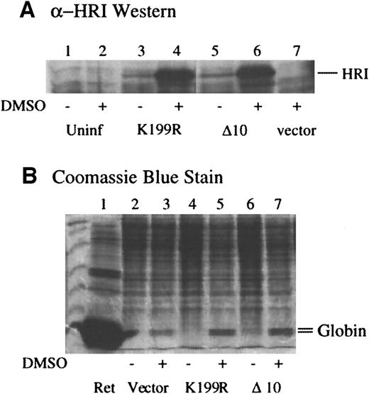 Fig. 3. Expression of inactive mutant HRI increases the α and β globin contents of differentiating MEL cells. / (A) Expression of retrovirally transduced HRI in MEL cells. MEL cells expressing vector alone, K199R HRI, or Δ10 HRI were plated at 1 × 107 cells per 100-mm plate the night before treatment with 2% DMSO as indicated. Cells were counted and harvested on day 5. Cells were lysed at 1 × 108 cells/mL. Cytoplasmic extracts, equivalent to 2 × 106 cells, were used for anti-HRI Western blot analysis. Lanes 1 and 2 are uninfected MEL cell controls; lanes 3 and 4 are K199R-infected cell extracts; lanes 5 and 6 are Δ10 HRI-infected cell extracts; lane 7, vector-infected cell extracts. (B) α and β globin contents of MEL cells expressing mutant HRI. Lanes 2, 4, and 6 are induced with DMSO. Cytoplasmic extracts, equivalent to 5 × 105 cells, were separated by 15% SDS-PAGE and stained with Coomassie blue. The positions of α and β globin were marked. Lane 1, rabbit reticulocyte lysates. Lanes 2 and 3, cell extracts; lanes 4 and 5, K199R HRI-expressing cell extracts; lanes 6 and 7, Δ10 HRI-expressing cell extracts; lanes 3, 5, and 7 are treated with DMSO.