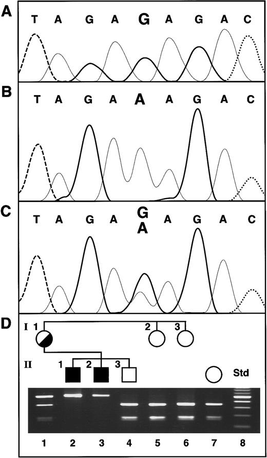 Fig. 1. Sequence of the. / ABC7 gene mutation in XLSA/A and confirmation of the presence of the mutation in family members. (A) Normal female control. The bases are distinguished by heavy solid lines, G; light solid lines, A; dashed lines, T; and dotted lines, C. (B) Proband II-1. (C) Heterozygous mother of the proband. (D) Restriction analysis for confirmation of the exon 10 mutation. The Std lane contains a 100-bp increment ladder, with the brighter band 500 bp. The presence of the G1305A mutation was assayed by restriction analysis withBsmAI, which digests only the normal allele. Thus, in the absence of the mutation, the 501-bp PCR product is cleaved into fragments of 330 and 171 bp.