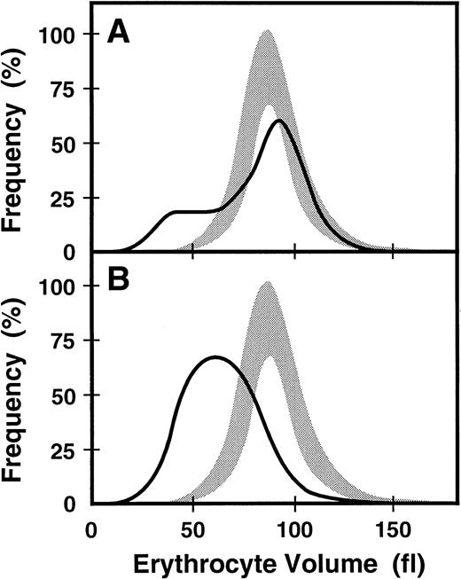 Fig. 2. Erythrocyte size distribution in normal and. / ABC7 mutant cells. Shaded bands are the ranges of values for the volumes of normal erythrocytes. Solid lines are the size distributions for erythrocytes from the heterozygous mother (A) and her affected son (B).