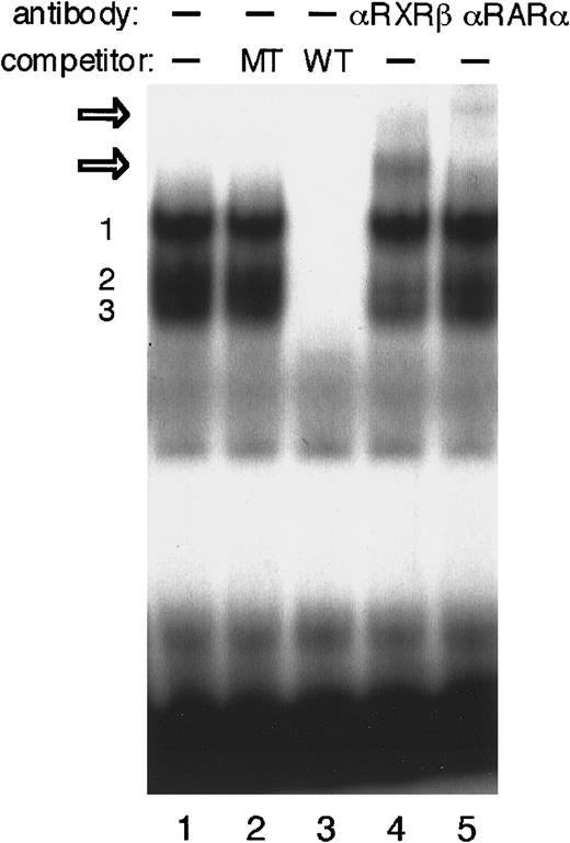 Fig. 5. EMSA to identify P19 nuclear proteins that interact with DR-2 in the Epo gene. / EMSA was performed using the DR-2 oligonucleotide probe. Nuclear extracts from P19 cells cultured with 5 × 10−7 mol/L all-trans RA for 20 hours were incubated with the radiolabeled wild-type DR-2 (DR-2 WT) probe in the absence of a competitor (lane 1) and in the presence of 100-fold molar excess of the unlabeled mutant DR-2 (DR-2 MT) probe (lane 2) or the unlabeled wild-type DR-2 (DR-2 WT) probe (lane 3). Three specific products (numbered 1, 2, and 3 on the left side) were found. Antibodies to RXRβ (lane 4) and RARα (lane 5) were incubated with nuclear extracts before the binding reactions were done. Two supershifted complexes appeared upon incubation with both antibodies (open arrows). Nuclear extracts from P19 cells cultured without RA produced the same results (not shown).