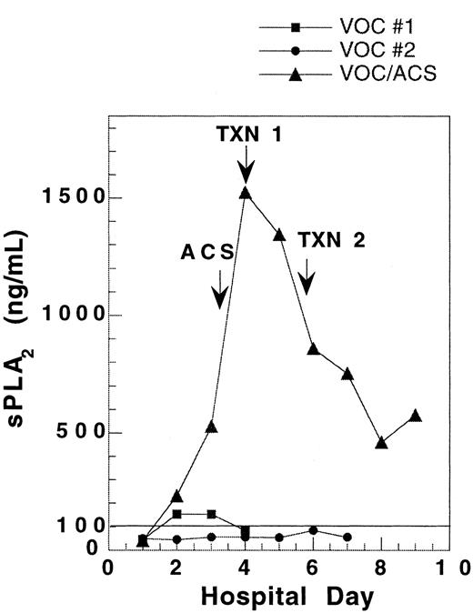 Fig. 1. Pattern of sPLA2 concentration in a single SCD patient hospitalized for vaso-occlusive crisis on 3 occasions. / During 2 hospitalizations for uncomplicated vaso-occlusive crisis(VOC), sPLA2 concentration remained low. When the patient developed ACS 2 days into an admission for VOC, the sPLA2 rose to levels 10-fold higher than in uncomplicated VOC. VOC no. 1, ▪; VOC no. 2, ●; VOC/ACS, ▴.