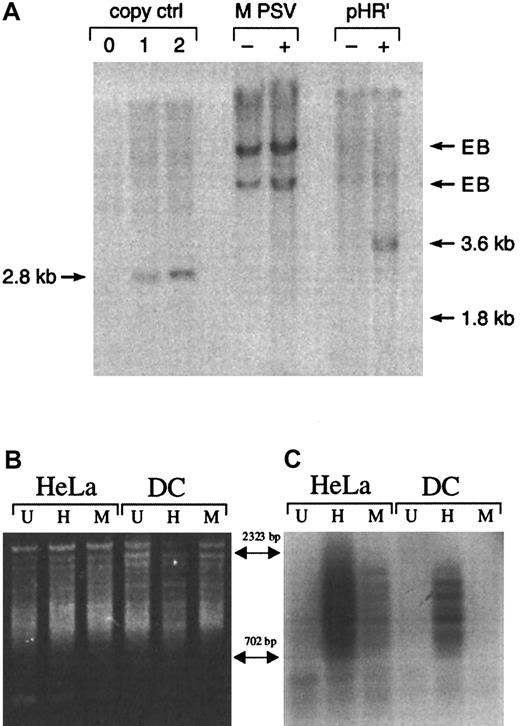 Fig. 3. Gene transfer in human monocyte-derived DCs with MPSV-NTP or pHR'NTP. / (A) Detection of vector sequence in DCs by Southern blot analysis. DCs were infected on day 4 at an MOI of 4 with the oncoretroviral vector MPSV-NTP (MPSV) or the lentiviral vector pHR'NTP (pHR'). Four days after infection genomic DNA was extracted and digested with eitherNheI (MPSV-NTP) or ScaI (pHR'NTP), which cut in the LTR. Southern blot analysis was performed using a radiolabeled NTP complementary DNA probe. The left 3 lanes represent copy controls obtained from MEL clones bearing 0, 1, or 2 copies of the MLV vector SFG-NTP digested with NheI. Position of the signals expected for the vector DNAs are indicated (copy control = 2.8 kb; MPSV = 1.8 kb; pHR' = 3.6 kb). EB indicates endogenous bands; −, untransduced; +, transduced. No band was observed in the MPSV+ lane, even after extended exposure (24 hours in Figure 3; 10 days for extended exposure). (B,C) Detection of integrated lentiviral vector DNA by Alu PCR. HeLa cells and DCs were either untreated (U) or infected with the HIV-based vector pHR'NTP (H) or the MLV-based vector MPSV-NTP (M). Proviral junctions were amplified using the primers 3′Alu and NTP3. PCR products were analyzed by gel electrophoresis (B) and Southern blot hybridization with an NTP-specific probe (C).