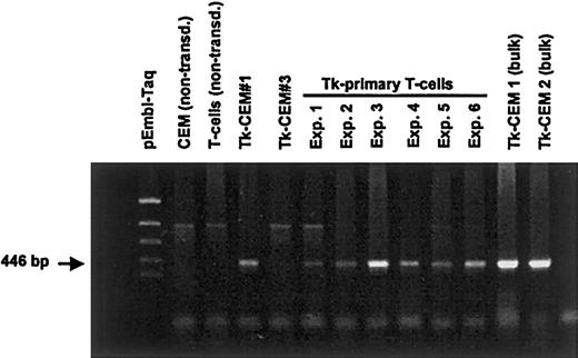 Fig. 5. PCR amplification of the truncated. / HSV-Tk gene from genomic DNA obtained from transduced and selected primary T lymphocytes. The PCRs were set up using primers (HTK8+ and HTK1−, 446 bp) that specifically amplified the spliced form of the HSV-Tk gene in the GCV-resistant CEM-Tk clones.