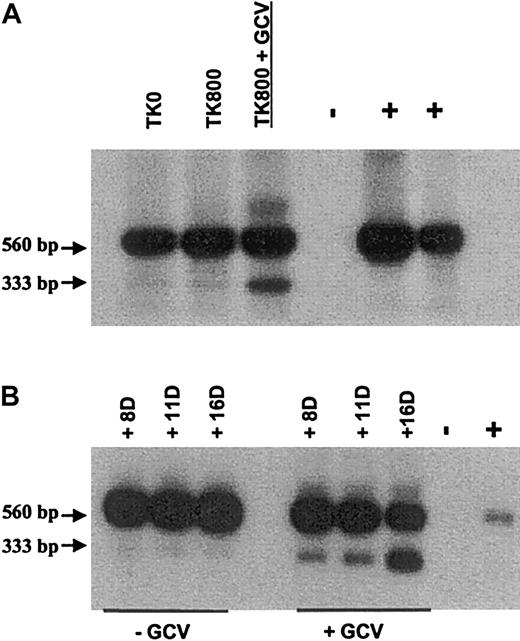 Fig. 6. Southern blot of pTK/RTK2 PCR (35 cycles) products, from transduced primary T cells in culture with or without GCV. / (A) PCR amplification of the HSV-Tk sequence in transduced/unselected T cells (TK0), transduced/G418-selected T cells (TK800) cultured in the absence of GCV and with 1 μg/mL GCV for 7 days (TK800 + GCV). (B) Transduced primary T cells after 8, 11, and 16 days of culture in the presence (1 μg/mL) or absence of GCV. Positive (DNA from G1Tk1SvNa vector producer cells) and negative controls (nontransduced primary T cells) were used.